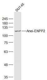 ENPP2 Antibody in Western Blot (WB)