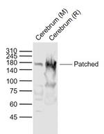 Patched Antibody in Western Blot (WB)