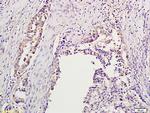 Aurora A/B/C Antibody in Immunohistochemistry (Paraffin) (IHC (P))