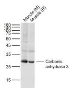 Carbonic anhydrase 3 Antibody in Western Blot (WB)
