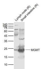 MGMT Antibody in Western Blot (WB)