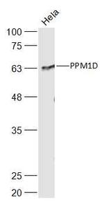 PPM1D Antibody in Western Blot (WB)