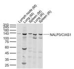 NALP3/CIAS1 Antibody in Western Blot (WB)