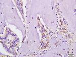 IL4R Antibody in Immunohistochemistry (Paraffin) (IHC (P))