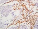 IL-13Ra2 Antibody in Immunohistochemistry (Paraffin) (IHC (P))