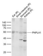 PNPLA1 Antibody in Western Blot (WB)