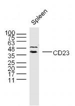 CD23/Fc EpsilonR 2 Antibody in Western Blot (WB)