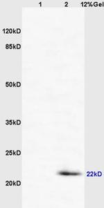 CD69/CLEC2C/AIM Antibody in Western Blot (WB)