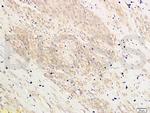 HOXA10 Antibody in Immunohistochemistry (Paraffin) (IHC (P))
