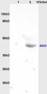 HOXA10 Antibody in Western Blot (WB)