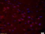 Phospho-PRKCB (Thr500) Antibody in Immunohistochemistry (Paraffin) (IHC (P))