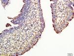CD44 Antibody in Immunohistochemistry (Paraffin) (IHC (P))