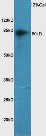 CD44 Antibody in Western Blot (WB)