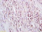 GTSE-1 Antibody in Immunohistochemistry (Paraffin) (IHC (P))