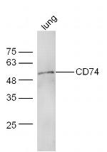 CD74 Antibody in Western Blot (WB)