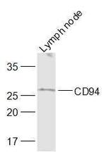 CD94/KLRD1 Antibody in Western Blot (WB)