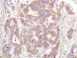CD151 Antibody in Immunohistochemistry (Paraffin) (IHC (P))