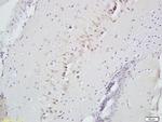 CD160/By55 Antibody in Immunohistochemistry (Paraffin) (IHC (P))