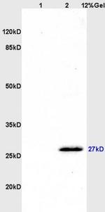 CD160/By55 Antibody in Western Blot (WB)