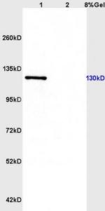 CD163/M130 Antibody in Western Blot (WB)