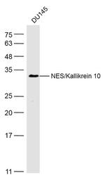 NES1/KLK10 Antibody in Western Blot (WB)