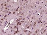 Versican Antibody in Immunohistochemistry (Paraffin) (IHC (P))