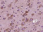 Versican Antibody in Immunohistochemistry (Paraffin) (IHC (P))