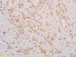 GLUT12 Antibody in Immunohistochemistry (Paraffin) (IHC (P))