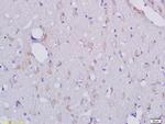 CLEC1/CLEC1A Antibody in Immunohistochemistry (Paraffin) (IHC (P))