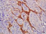 EGFRv3 Antibody in Immunohistochemistry (Paraffin) (IHC (P))