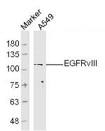 EGFRv3 Antibody in Western Blot (WB)