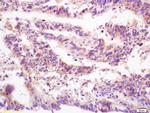 DEP1/PTPRJ Antibody in Immunohistochemistry (Paraffin) (IHC (P))