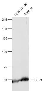 DEP1/PTPRJ Antibody in Western Blot (WB)