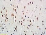 G-CSFR Antibody in Immunohistochemistry (Paraffin) (IHC (P))