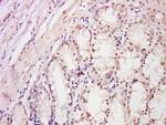 DDB2 Antibody in Immunohistochemistry (Paraffin) (IHC (P))
