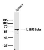IL-18R Beta/CD218b Antibody in Western Blot (WB)