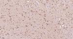 IL22RA2 Antibody in Immunohistochemistry (Paraffin) (IHC (P))