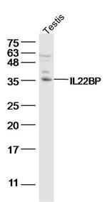 IL22RA2 Antibody in Western Blot (WB)