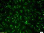 Langerin/CD207 Antibody in Immunocytochemistry (ICC/IF)