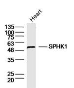 SPHK1 Antibody in Western Blot (WB)