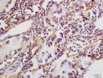 CLEC5A Antibody in Immunohistochemistry (Paraffin) (IHC (P))
