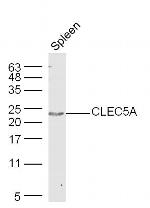 CLEC5A Antibody in Western Blot (WB)