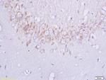 Plexin B1 Antibody in Immunohistochemistry (Paraffin) (IHC (P))