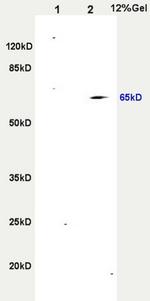CD265 Antibody in Western Blot (WB)