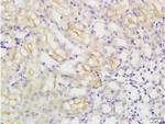 MCT4 Antibody in Immunohistochemistry (Paraffin) (IHC (P))
