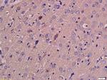 MCT4 Antibody in Immunohistochemistry (Paraffin) (IHC (P))