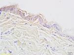Cytokeratin 10 Antibody in Immunohistochemistry (Paraffin) (IHC (P))
