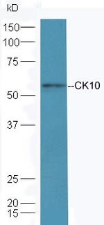 Cytokeratin 10 Antibody in Western Blot (WB)
