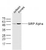 SIRP Alpha Antibody in Western Blot (WB)