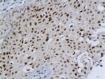 DBC1/deleted in bladder cancer 1 Antibody in Immunohistochemistry (Paraffin) (IHC (P))